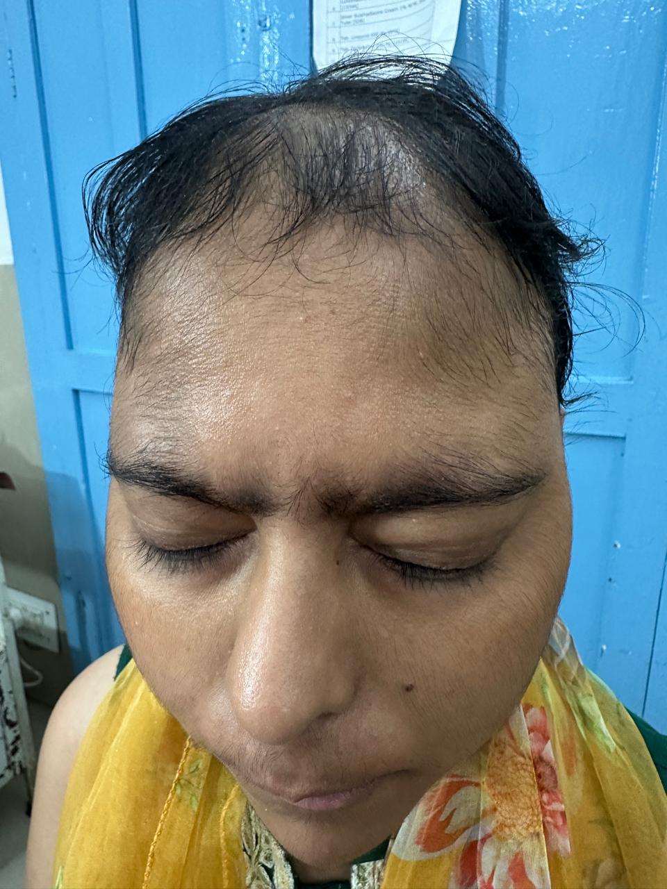 Crown Reconstruction — after treatment